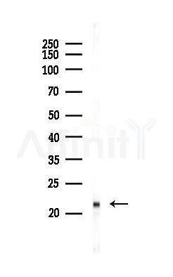 Cofilin Mouse Monoclonal Antibody - Western blot analysis of lysates from RAW264.