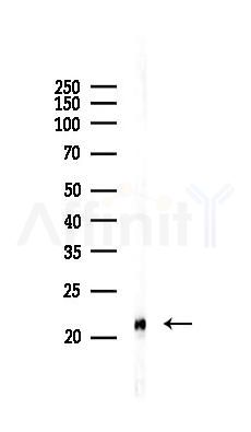 Cofilin Mouse Monoclonal Antibody - Western blot analysis of lysates from COLO205 cells(UV 30min treatment), using Cofilin Mouse Monoclonal Antibody at 1/1000 dilution.