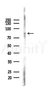 STAT4 Mouse Monoclonal Antibody - Western blot analysis of lysates from K562 cells(LPS 4h treatment), using STAT4 Mouse Monoclonal Antibody at 1/1000 dilution.