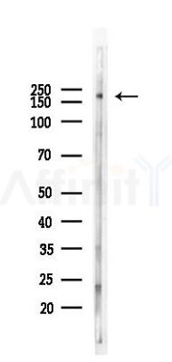 VEGFR1 Mouse Monoclonal Antibody - Western blot analysis of lysates from HUVEC cells(UV 30min treatment), using VEGFR1 Mouse Monoclonal Antibody at 1/1000 dilution.