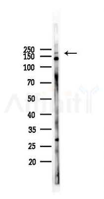 VEGFR1 Mouse Monoclonal Antibody - Western blot analysis of lysates from K562 cells(LPS 4h treatment), using VEGFR1 Mouse Monoclonal Antibody at 1/1000 dilution.