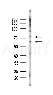 Tau Mouse Monoclonal Antibody - Western blot analysis of lysates from Rat heart, using Tau Mouse Monoclonal Antibody at 1/1000 dilution.
