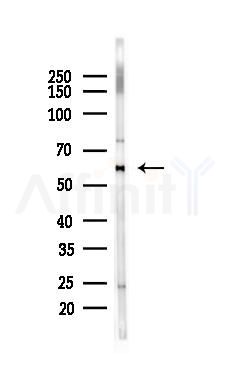 PKM2 Mouse Monoclonal Antibody - Western blot analysis of lysates from Rat heart, using PKM2 Mouse Monoclonal Antibody at 1/1000 dilution.
