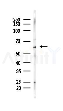 PKM2 Mouse Monoclonal Antibody - Western blot analysis of lysates from Rat heart, using PKM2 Mouse Monoclonal Antibody at 1/1000 dilution.
