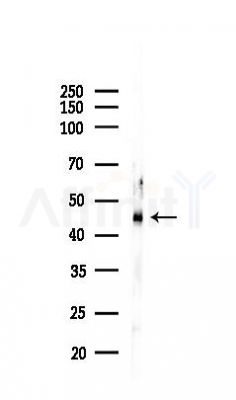 GPR120 Mouse Monoclonal Antibody - Western blot analysis of lysates from PC12 cells(starvation 24h treatment), using GPR120 Mouse Monoclonal Antibody at 1/1000 dilution.