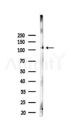 GAB1 Mouse Monoclonal Antibody - Western blot analysis of lysates from K562 cells(starvation 24h treatment), using GAB1 Mouse Monoclonal Antibody at 1/1000 dilution.