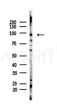 Integrin beta3 Mouse Monoclonal Antibody - Western blot analysis of lysates from HUVEC cells(starvation 24h treatment), using Integrin beta3 Mouse Monoclonal Antibody at 1/1000 dilution.