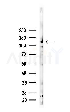 CD34 Mouse Monoclonal Antibody - Western blot analysis of lysates from K562 cells(starvation 24h treatment), using CD34 Mouse Monoclonal Antibody at 1/1000 dilution.