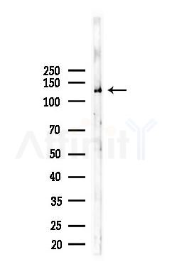 Vinculin Mouse Monoclonal Antibody - Western blot analysis of lysates from K562 cells(starvation 24h treatment), using Vinculin Mouse Monoclonal Antibody at 1/1000 dilution.