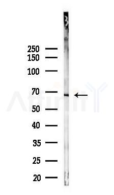 Estrogen Receptor alpha Mouse Monoclonal Antibody - Western blot analysis of lysates from K562 cells(starvation 24h treatment), using Estrogen Receptor alpha Mouse Monoclonal Antibody at 1/1000 dilution.