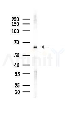 Tau Mouse Monoclonal Antibody - Western blot analysis of lysates from HUVEC cells(starvation 24h treatment), using Tau Mouse Monoclonal Antibody at 1/1000 dilution.