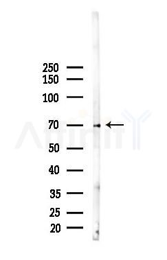 PKC beta 1 Mouse Monoclonal Antibody - Western blot analysis of lysates from K562 cells(starvation 24h treatment), using PKC beta 1 Mouse Monoclonal Antibody at 1/1000 dilution.