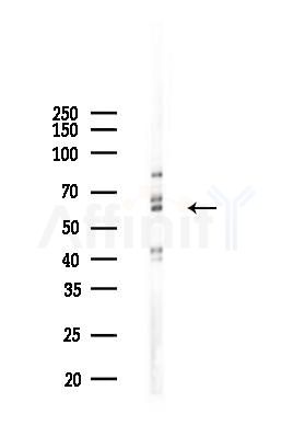 G3BP-1 Mouse Monoclonal Antibody - Western blot analysis of lysates from 293 cells(heat-shock 45min treatment), using G3BP-1 Mouse Monoclonal Antibody at 1/1000 dilution.
