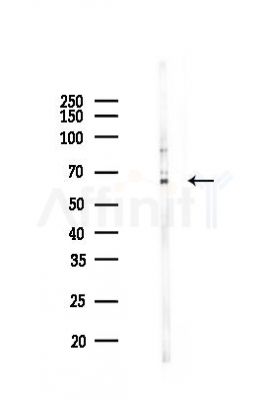 G3BP-1 Mouse Monoclonal Antibody - Western blot analysis of lysates from Hela cells(UV 30min treatment), using G3BP-1 Mouse Monoclonal Antibody at 1/1000 dilution.