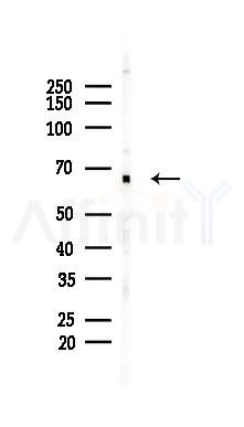 G3BP-1 Mouse Monoclonal Antibody - Western blot analysis of lysates from HUVEC cells(starvation 24h treatment), using G3BP-1 Mouse Monoclonal Antibody at 1/1000 dilution.