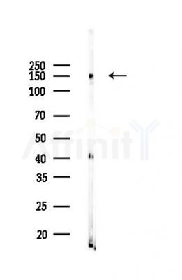 c-Met Mouse Monoclonal Antibody - Western blot analysis of lysates from Rat brain, using c-Met Mouse Monoclonal Antibody at 1/1000 dilution.