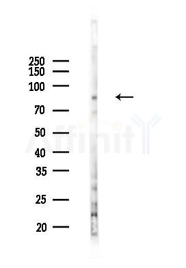Cortactin Mouse Monoclonal Antibody - Western blot analysis of lysates from A2780 cells(LPS 4h treatment), using Cortactin Mouse Monoclonal Antibody at 1/1000 dilution.