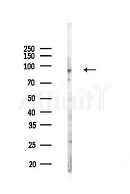 Cortactin Mouse Monoclonal Antibody - Western blot analysis of lysates from K562 cells(LPS 4h treatment), using Cortactin Mouse Monoclonal Antibody at 1/1000 dilution.