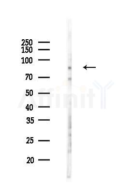 Cortactin Mouse Monoclonal Antibody - Western blot analysis of lysates from COLO205 cells(LPS 4h treatment), using Cortactin Mouse Monoclonal Antibody at 1/1000 dilution.