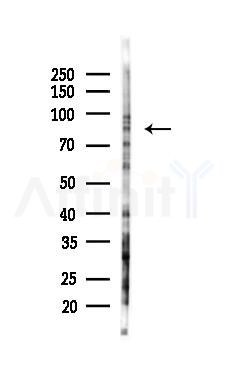 Cortactin Mouse Monoclonal Antibody - Western blot analysis of lysates from K562 cells(UV 30min treatment), using Cortactin Mouse Monoclonal Antibody at 1/1000 dilution.
