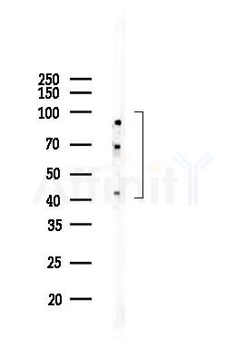ADRB2 Mouse Monoclonal Antibody - Western blot analysis of lysates from PC12 cells(starvation 24h treatment), using ADRB2 Mouse Monoclonal Antibody at 1/1000 dilution.