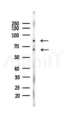 ADRB2 Mouse Monoclonal Antibody - Western blot analysis of lysates from Rat heart, using ADRB2 Mouse Monoclonal Antibody at 1/1000 dilution.