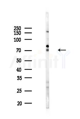 PRC1 Mouse Monoclonal Antibody - Western blot analysis of lysates from B16F10-LUC cells(heat-shock 45min treatment), using PRC1 Mouse Monoclonal Antibody at 1/1000 dilution.