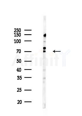 PRC1 Mouse Monoclonal Antibody - Western blot analysis of lysates from PC12 cells(starvation 24h treatment), using PRC1 Mouse Monoclonal Antibody at 1/1000 dilution.