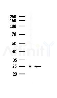 PGP9.5 Mouse Monoclonal Antibody - Western blot analysis of lysates from PC12 cells(starvation 24h treatment), using PGP9.