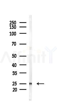 PGP9.5 Mouse Monoclonal Antibody - Western blot analysis of lysates from HUVEC cells(starvation 24h treatment), using PGP9.