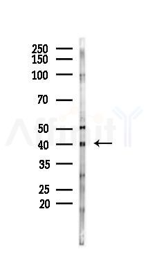 Fas Ligand Mouse Monoclonal Antibody - Western blot analysis of lysates from HUVEC cells(starvation 24h treatment), using Fas Ligand Mouse Monoclonal Antibody at 1/1000 dilution.