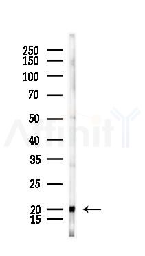 DDIT3/CHOP Mouse Monoclonal Antibody - Western blot analysis of lysates from Mouse kidney, using DDIT3/CHOP Mouse Monoclonal Antibody at 1/1000 dilution.