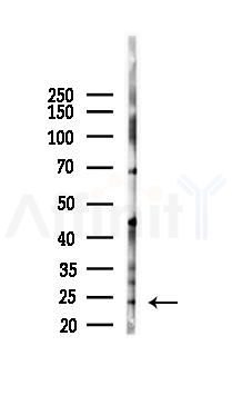 DDIT3/CHOP Mouse Monoclonal Antibody - Western blot analysis of lysates from K562 cells(starvation 24h treatment), using DDIT3/CHOP Mouse Monoclonal Antibody at 1/1000 dilution.