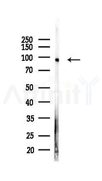 TGF beta Receptor III Mouse Monoclonal Antibody - Western blot analysis of lysates from PC12 cells(starvation 24h treatment), using TGF beta Receptor III Mouse Monoclonal Antibody at 1/1000 dilution.