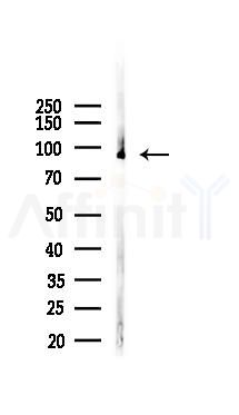 TGF beta Receptor III Mouse Monoclonal Antibody - Western blot analysis of lysates from K562 cells(starvation 24h treatment), using TGF beta Receptor III Mouse Monoclonal Antibody at 1/1000 dilution.
