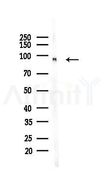 TGF beta Receptor III Mouse Monoclonal Antibody - Western blot analysis of lysates from Rat heart, using TGF beta Receptor III Mouse Monoclonal Antibody at 1/1000 dilution.
