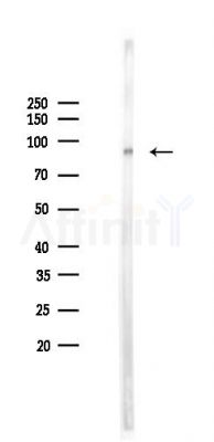 TBK1 Mouse Monoclonal Antibody - Western blot analysis of lysates from Mouse heart, using TBK1 Mouse Monoclonal Antibody at 1/1000 dilution.