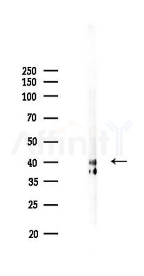 hnRNP C1/C2 Mouse Monoclonal Antibody - Western blot analysis of lysates from COLO205 cells(starvation 24h treatment), using hnRNP C1/C2 Mouse Monoclonal Antibody at 1/1000 dilution.