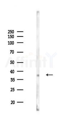 Cathepsin D Mouse Monoclonal Antibody - Western blot analysis of lysates from COLO205 cells(starvation 24h treatment), using Cathepsin D Mouse Monoclonal Antibody at 1/1000 dilution.