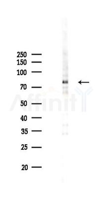 PKC gamma Mouse Monoclonal Antibody - Western blot analysis of lysates from COLO205 cells(starvation 24h treatment), using PKC gamma Mouse Monoclonal Antibody at 1/1000 dilution.