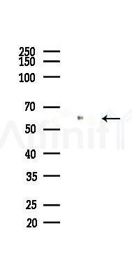 PKM2 Mouse Monoclonal Antibody - Western blot analysis of lysates from COLO205 cells(starvation 24h treatment), using PKM2 Mouse Monoclonal Antibody at 1/1000 dilution.