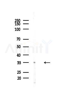 Annexin A2 Mouse Monoclonal Antibody - Western blot analysis of lysates from COLO205 cells(starvation 24h treatment), using Annexin A2 Mouse Monoclonal Antibody at 1/1000 dilution.