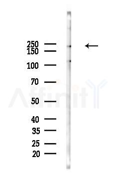 LRP6 Mouse Monoclonal Antibody - Western blot analysis of lysates from Hela cells(heat-shock 45min treatment), using LRP6 Mouse Monoclonal Antibody at 1/1000 dilution.