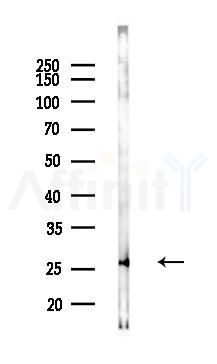 EIF6 Mouse Monoclonal Antibody - Western blot analysis of lysates from COLO205 cells(starvation 24h treatment), using EIF6 Mouse Monoclonal Antibody at 1/1000 dilution.
