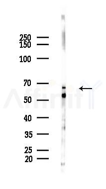 FOXO4 Mouse Monoclonal Antibody - Western blot analysis of lysates from Hela cells(heat-shock 45min treatment), using FOXO4 Mouse Monoclonal Antibody at 1/1000 dilution.