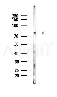 CTNNAL1 Mouse Monoclonal Antibody - Western blot analysis of lysates from COLO205 cells(starvation 24h treatment), using CTNNAL1 Mouse Monoclonal Antibody at 1/1000 dilution.