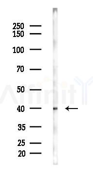 TDP43 Mouse Monoclonal Antibody - Western blot analysis of lysates from Hela cells(heat-shock 45min treatment), using TDP43 Mouse Monoclonal Antibody at 1/1000 dilution.