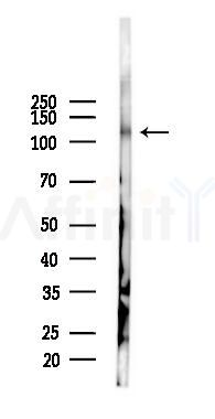 TrkA Mouse Monoclonal Antibody - Western blot analysis of lysates from Hela cells(heat-shock 45min treatment), using TrkA Mouse Monoclonal Antibody at 1/1000 dilution.