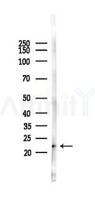 Peroxiredoxin 1 Mouse Monoclonal Antibody - Western blot analysis of lysates from Mouse heart, using Peroxiredoxin 1 Mouse Monoclonal Antibody at 1/1000 dilution.