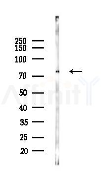 Zyxin Mouse Monoclonal Antibody - Western blot analysis of lysates from COLO205 cells(starvation 24h treatment), using Zyxin Mouse Monoclonal Antibody at 1/1000 dilution.